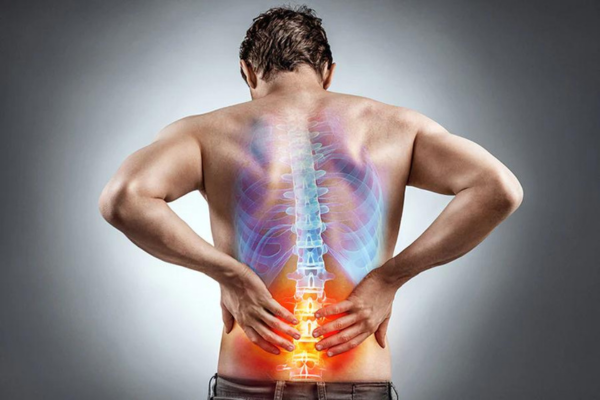 Sciatica​